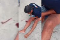 Korban bernama Marwan mengalami luka di kaki sebelah kanan di bawah lutut saat melintas di Jalan S Parman, Banjarmasin Tengah, Senin (23/6/2025) sore. (foto: istimewa)