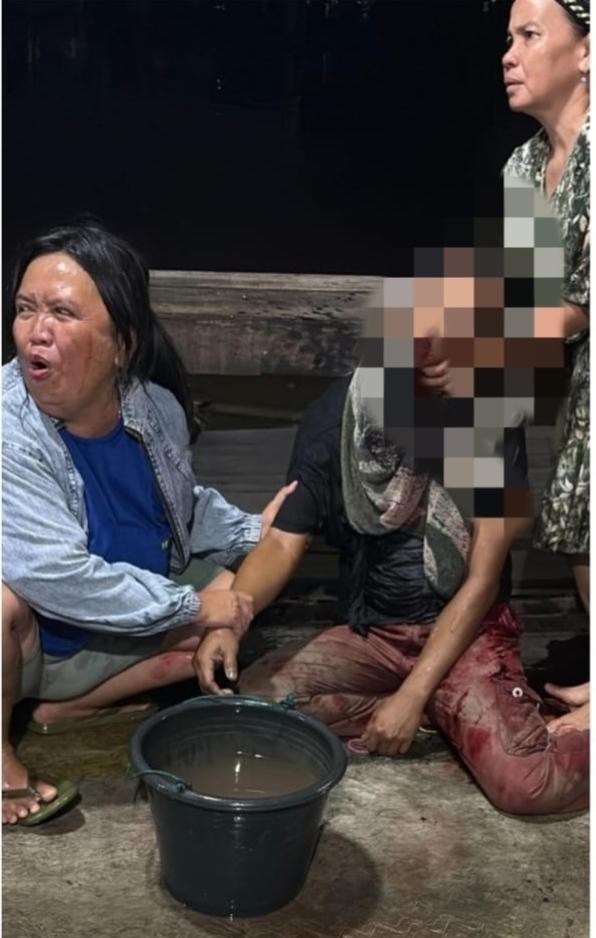 BERSIMBAH DARAH - Pria bersimbah darah bernama Andalan sempat ditolong warga di kawasan Teluk Masjid Jami I Banjarmasin, namun tewas setibanya di IGD RSUD Ulin, Rabu (1/4/2026) malam. (foto: istimewa)
